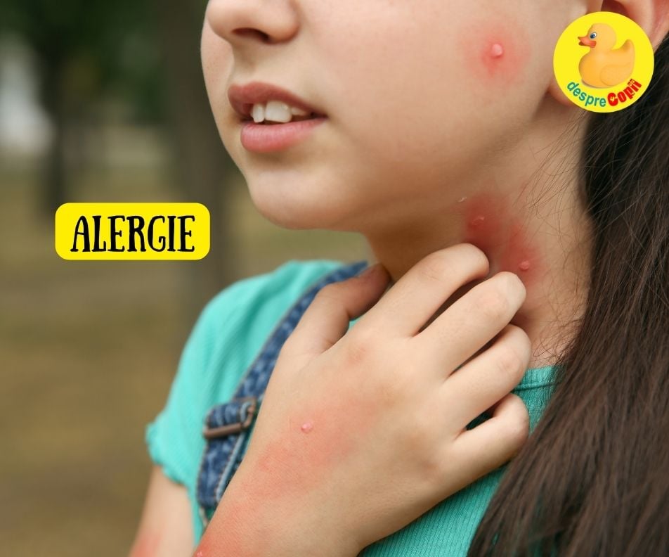 Alergiile la copil, cum le depistam si cum le tinem in frau -  simptome si tratament
