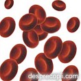 Anemia pernicioasa