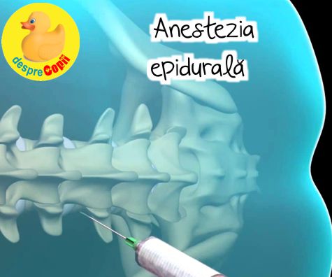 Anestezia epidurala: tot ce trebuie sa stii in avans