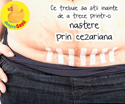 Ce trebuie sa stii inainte de a trece printr-o nastere prin cezariana