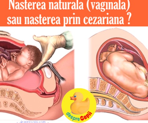 Nastere naturala sau nastere prin cezariana: ce alegem si de ce?