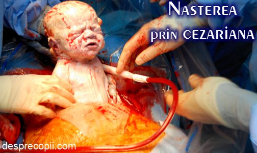 Nasterea prin cezariana