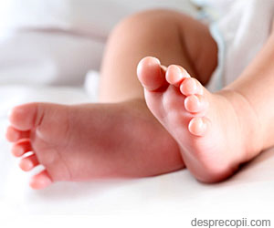 Piciorul stramb congenital la bebelus si tratarea lui