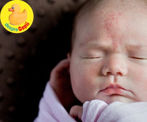 Semnele din nastere ale bebelusilor -  de ce apar si cum le recunosti - GHID complet