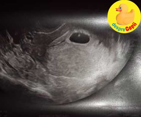 La 6 saptamani - prima ecografie a sarcinii numarul 3 - jurnal de sarcina