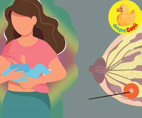 Alaptarea si abcesul mamar - simptome si tratament plus experienta personala a unei mamici