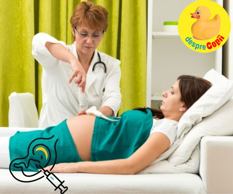 Amniocenteza in saptamana 12 - jurnal de sarcina
