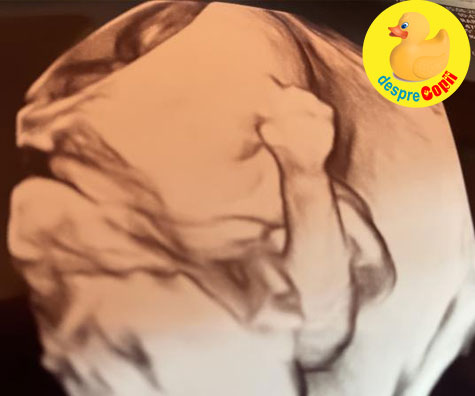 31 saptamani de sarcina: asteptam controlul si ecografia din trimestrul 3 - jurnal de sarcina