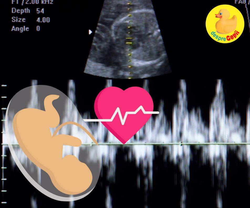 Săptămâna 7 de sarcină: cel mai frumos sunet, cel al inimii copilului - jurnal de sarcină