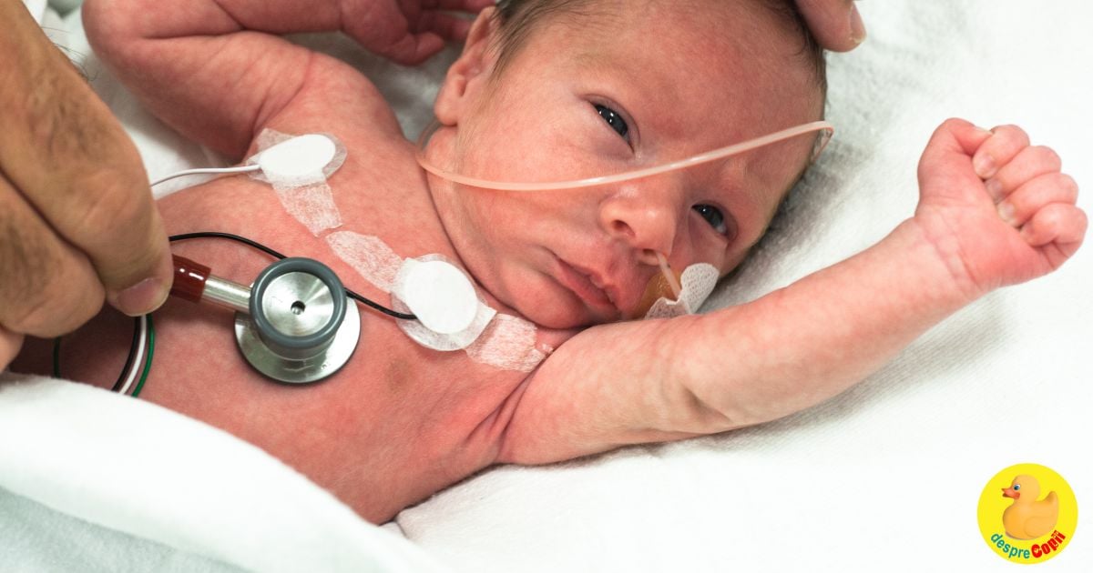 Prematuritatea si complicatiile sale - una dintre principalele cauze de mortalitate neonatala din Romania