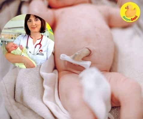 Cum avem grija de buricul nou-nascutului: sfatul medicului primar Neonatologie