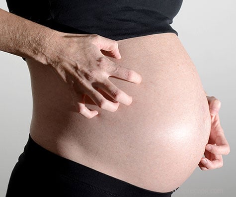Colestaza gravidica. Mancarimea intensa a pielii in timpul sarcinii – o afectiune specifica a trimestrului 3 de sarcina