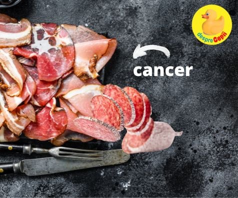 Mezelurile si preparatele din carne - legatura cu cancerul de colon