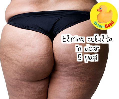 Elimina celulita pentru totdeauna in doar 5 pasi