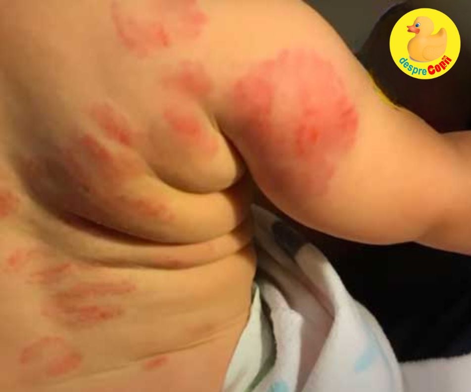 Cand iti iei copilul acasa de la cresa si ramai ingrozit de ce s-a putut intampla acolo...