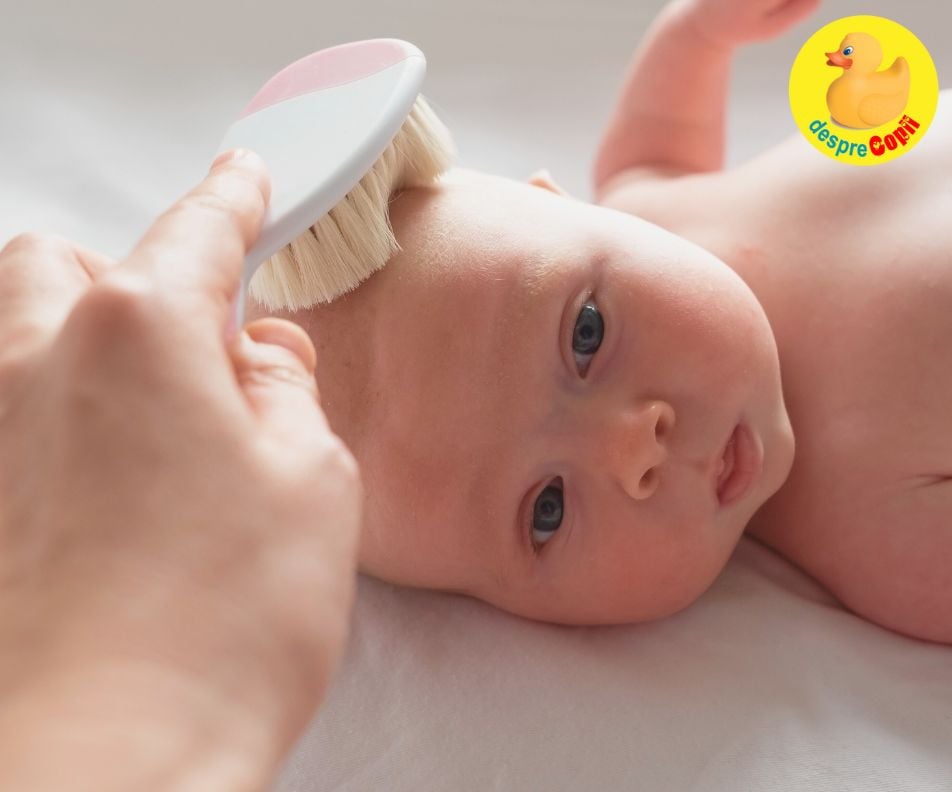 Crustele de lapte nu sunt periculoase! Afla ce sunt si cum dispar