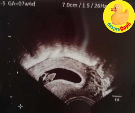 A doua ecografie -  emotii si mai mari decat la prima - jurnal de sarcina