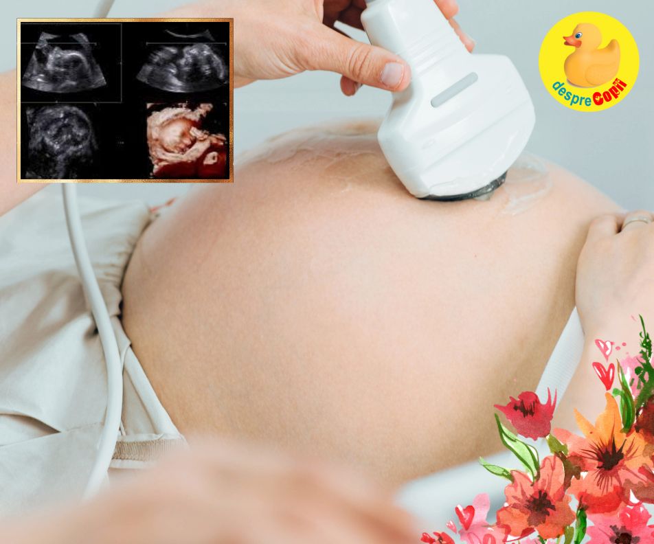 Saptamana 37 si bucuria risipita a ultimei ecografii cu bebe - jurnal de sarcina