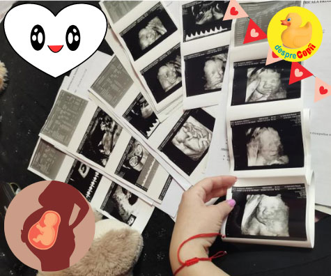 Ecografiile din sarcina: primul album foto al bebelinei - jurnal de sarcina