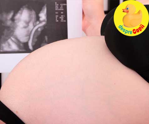 Bebe nu mai are cordonul ombilical in jurul gatului - jurnal de sarcina