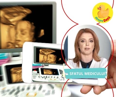 Ce este ecografia 3D si ecografia 4D si rolul lor in sarcina: sfatul medicului ginecolog