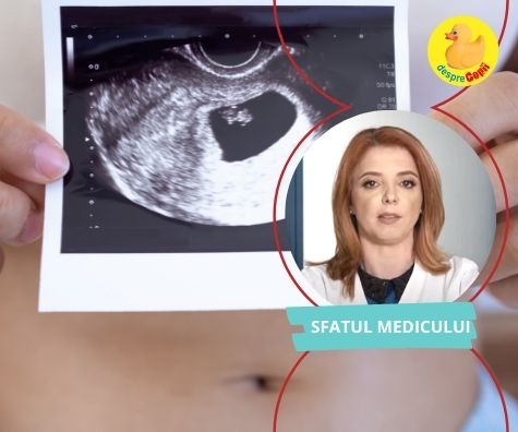 La cate saptamani se face prima ecografie de sarcina si de ce - sfatul medicului primar obstetrica-ginecologie