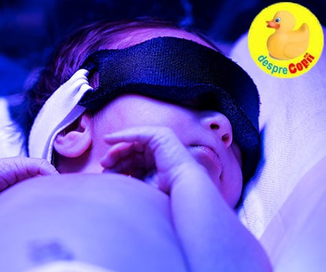 Fototerapia pentru icter la nou nascuti