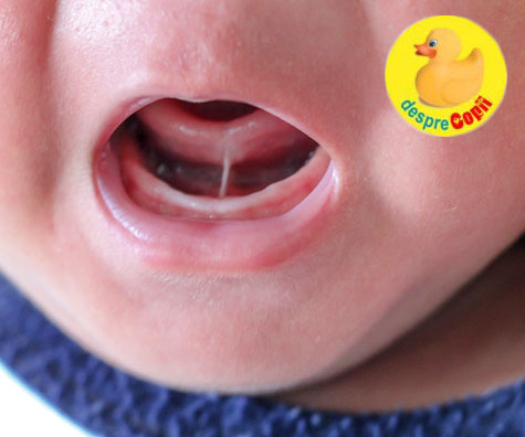 Frenul sublingual sau ankyloglossia