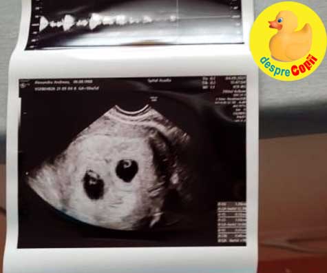 Prima morfologie cu 2 bebei sugubeti in burtica - jurnal de sarcina