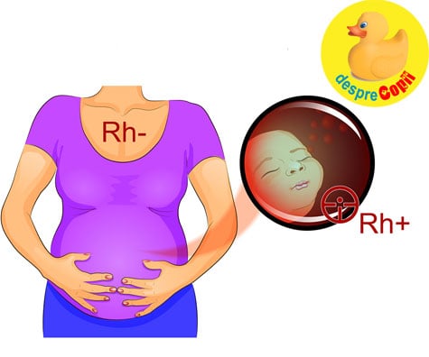 Ce se intampla daca eu si partenerul meu avem Rh diferit de sange? E un risc pentru sarcina?