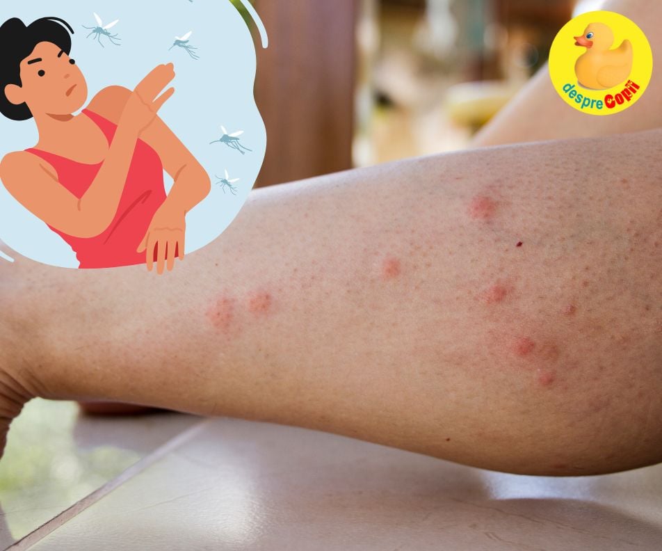 Vara, sezonul intepaturilor de insecte
