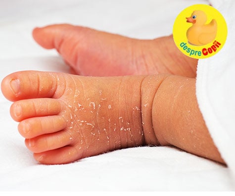 Leziuni cutanate comune la nou-nascuti: despre pielea bebelusilor - sfatul medicului