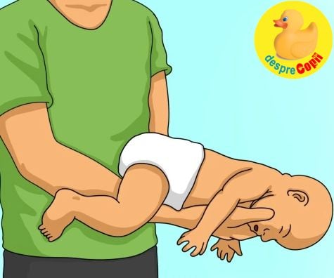 Metoda Heimlich primul ajutor in caz de inec cu mancare sau obiect: cum se aplica la bebelusi, copii sau adulti