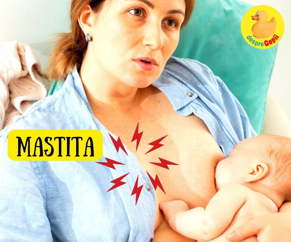 12 Remedii naturale pentru mastita - sprijin pentru a continua sa alaptezi