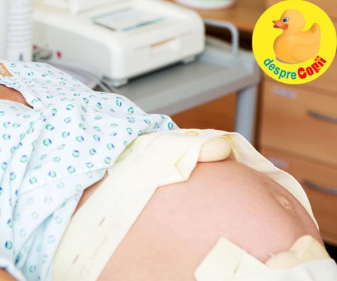 Cum este monitorizat bebelusul in timpul nasterii? Iata sfatul medicului specialist.