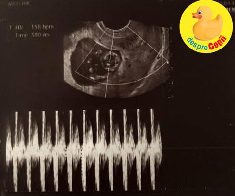 In saptamana 11 am asteptat incordati morfologia de trimestrul 1 si dublul testul -  am rasuflat usurati - jurnal de sarcina