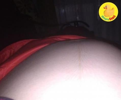Nasterea la Brasov: o cezariana la 39 saptamani, cu bebe avand circulara abdominala - la maternitatea Brasov