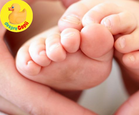Piciorul stramb congenital la bebelus si tratarea lui