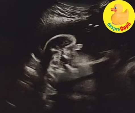 Diagnostic in saptamana 13: placenta joasa - jurnal de sarcina