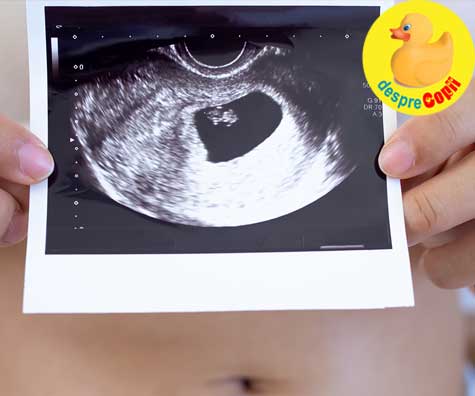 Prima ecografie din sarcina - jurnal de sarcina