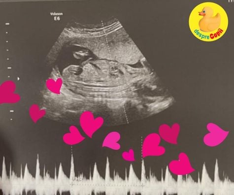 Prima ECO a lui bebe si primele batai de inima auzite - jurnal de sarcina