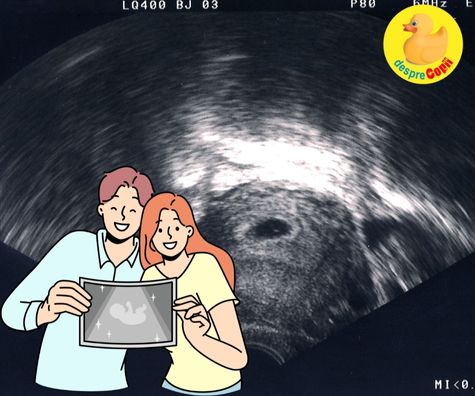 Prima vizita la medic si confirmarea sarcinii mult dorite - jurnal de sarcina
