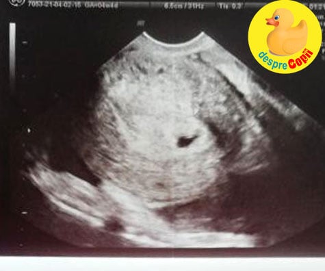 Prima ecografie a sarcinii la 4 saptamani: sotul plangea de fericire - jurnal de sarcina