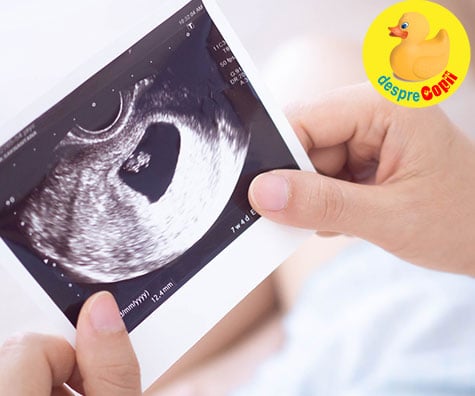 Saptamana 7: prima vizita la medic si prima ecografie - jurnal de sarcina
