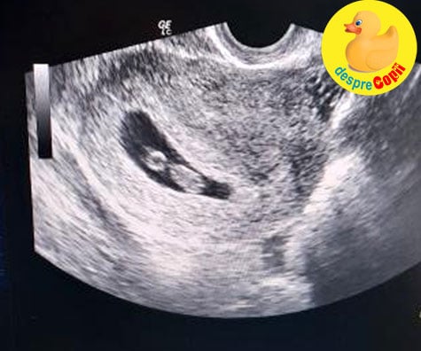 Prima ecografie la 7 saptamani: prima intalnire cu bebe - jurnal de sarcina