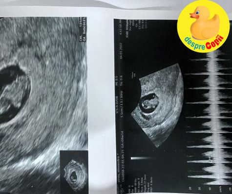 Prima morfologie la 12 saptamani - dar nu stim inca sigur daca e fetita sau baietel - jurnal de sarcina