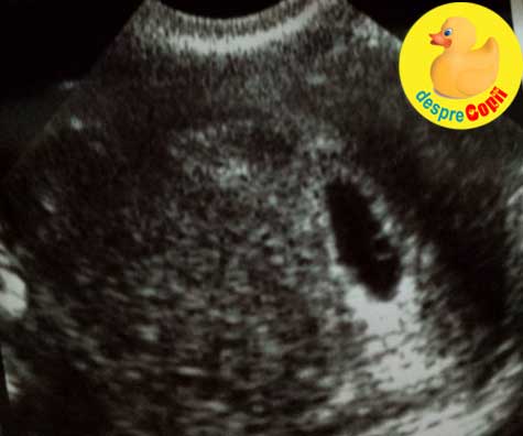 Primul trimestru de sarcina sau lectia supravietuirii - jurnal de sarcina