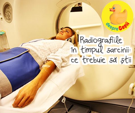 Sunt permise radiografiile in timpul sarcinii?