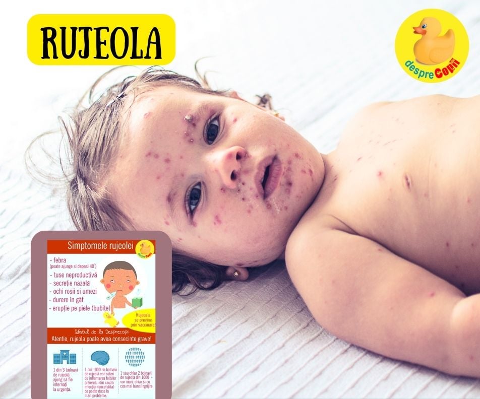 Rujeola la copil: simptomele acestei boli grave in infografic util