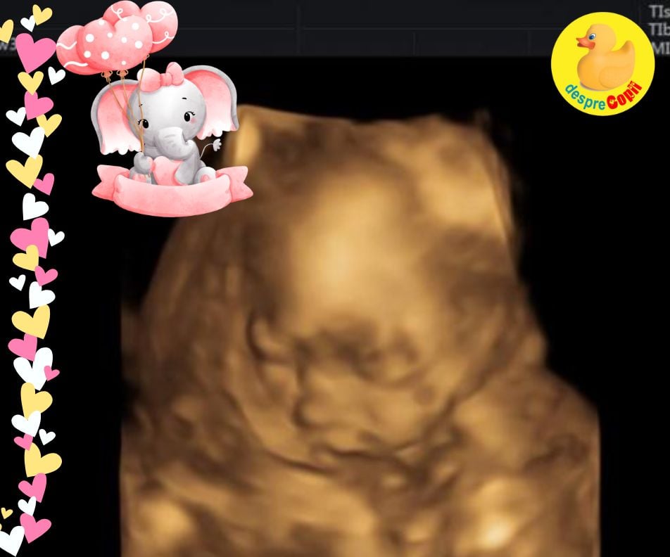 Saptamana 21: am aflat ca in urma unor complicatii urmeaza sa nasc prin cezariana - jurnal de sarcina